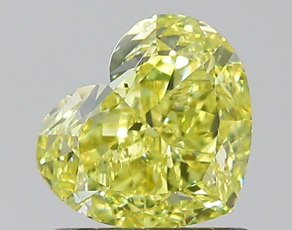 HEART  1.03 5.67*6.54*3.54